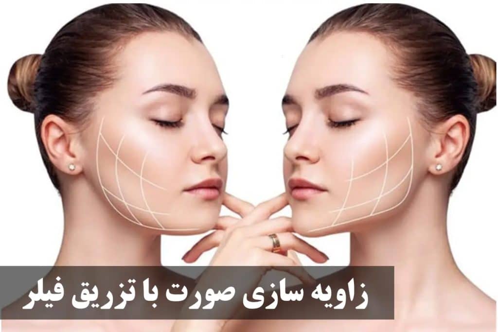 زاویه سازی صورت