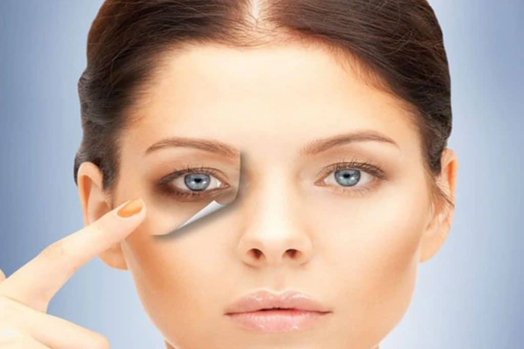 مشکلات دور چشم