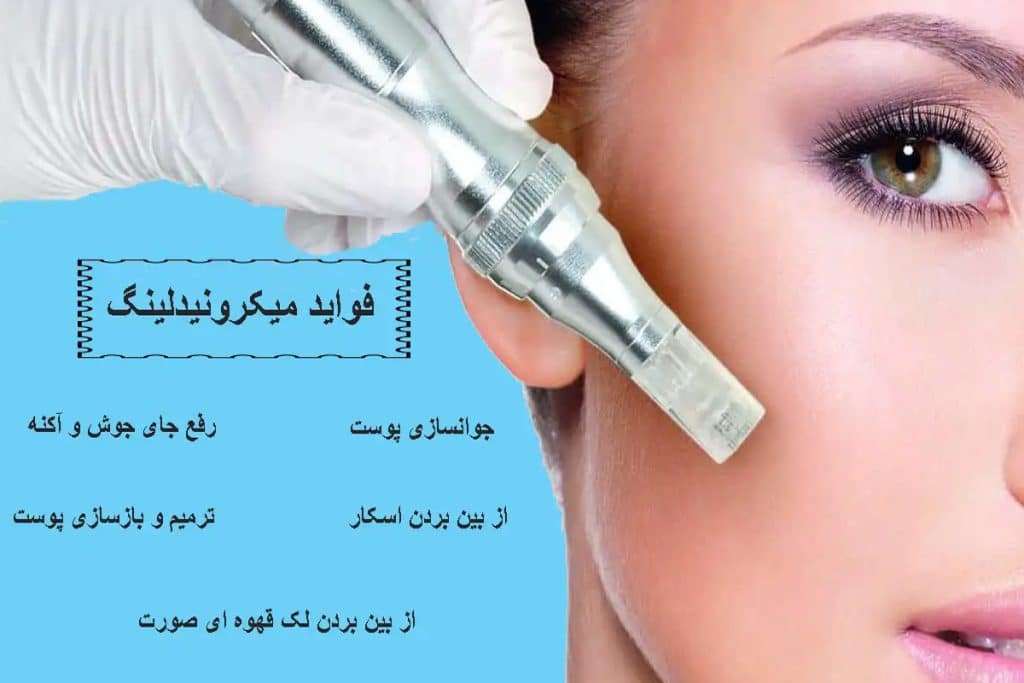 میکرونیدلینگ